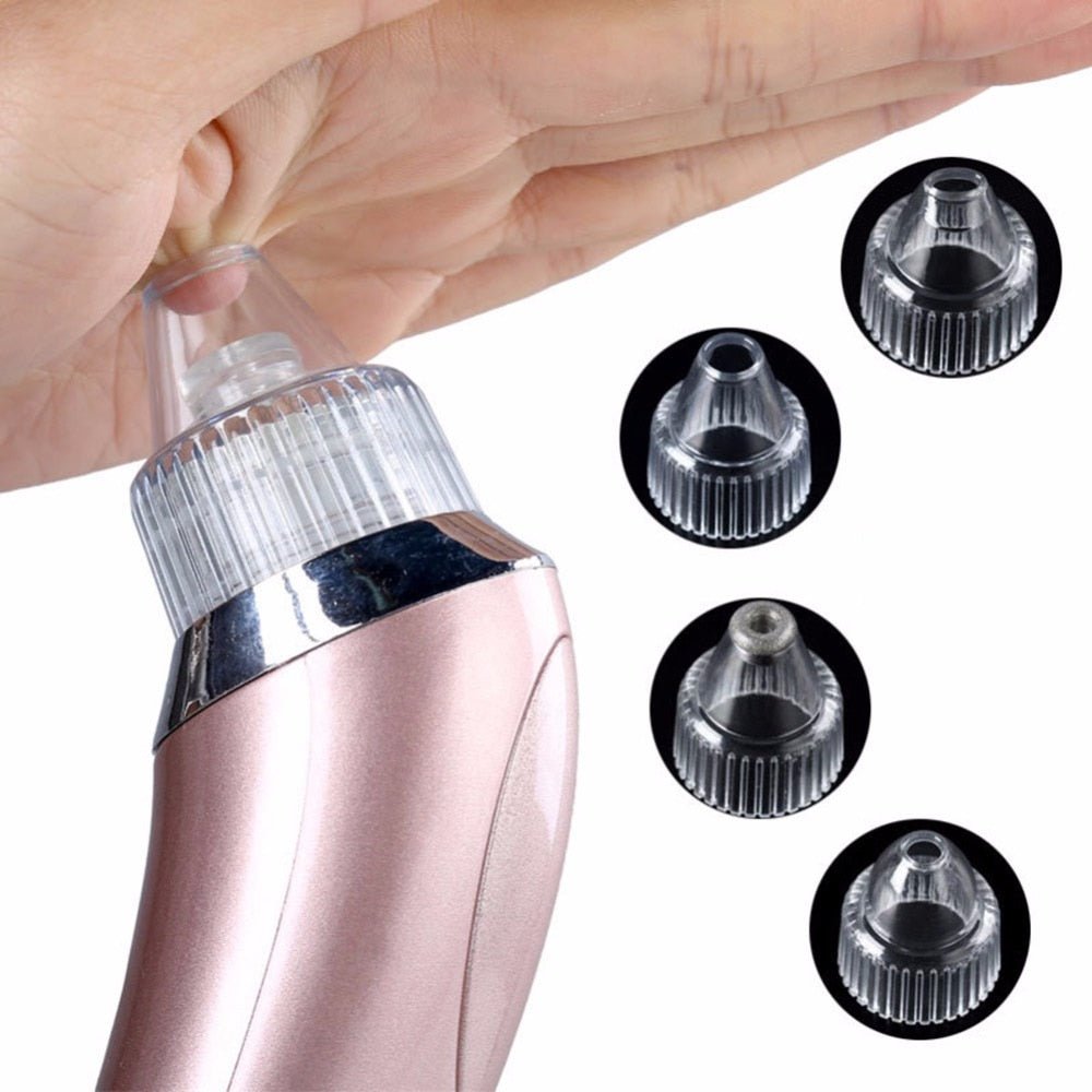 Comedone Vacuum Pro - I Want It